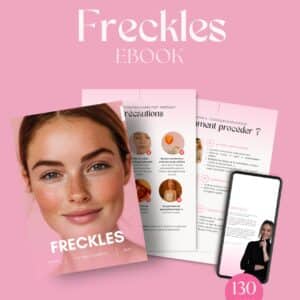 EBOOK TACHES DE ROUSSEUR